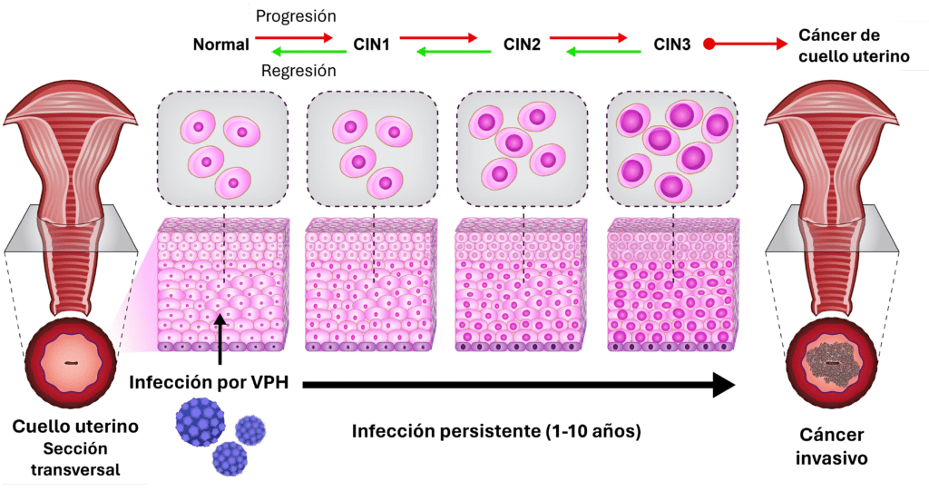 Fig 2. Un regalo inesperado: Virus del Papiloma Humano